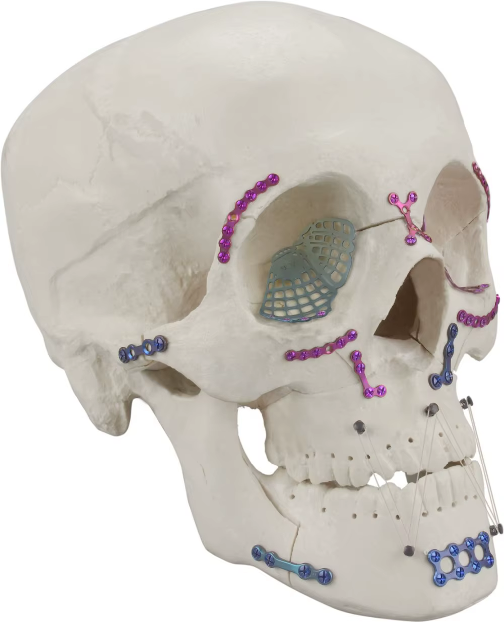 Maxilofacial